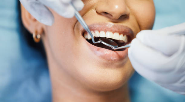 Best Mobile Emergency Dentist in Suisun City, CA